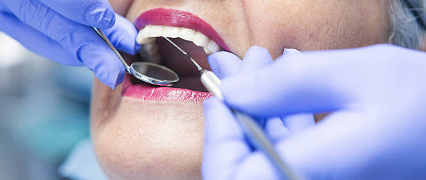 Best Emergency Cosmetic Dentistry in Rockport, IN